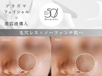 ゴーマルイチ(501)