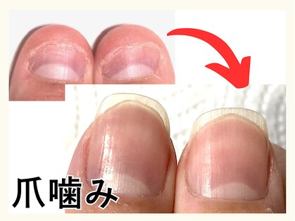広島深爪専門ネイルサロン ナッカの写真
