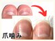 広島深爪専門ネイルサロン ナッカの写真