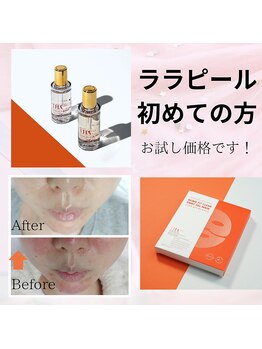 ケアユー 鴨島店(Care U)の写真/皮むけしないのでダウンタイムなし！お肌に優しいピーリングでお肌を育てましょう！