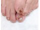 nail salon Fill.【7/1 NEWOPEN（予定）】の写真/足みせが増える季節に角質ケアで足元まできれいに！フットも持ち込み対応で、オシャレを堪能。