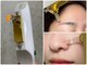 インベスト(INVEST)の写真/【顔脱毛で美肌ケア！】眉上・小鼻の細かいところも照射可能!!