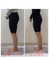 スタイルラボ高松/骨盤矯正の効果♪