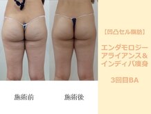 クレール アオヤマ(CLAIRE AOYAMA)