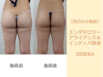 クレール アオヤマ(CLAIRE AOYAMA)の写真