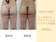 クレール アオヤマ(CLAIRE AOYAMA)の写真