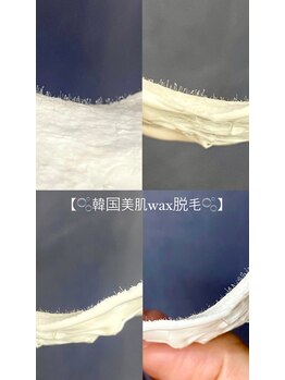 ラッシュバンビーナ(Lash Bambina)/韓国美肌Wax脱毛
