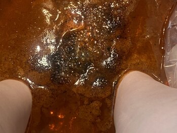 ミラージュ(Milarju)の写真/体内に溜まっている老廃物をごっそり排出促進♪30分3500円
