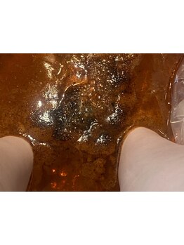 足のむくみを解消したい