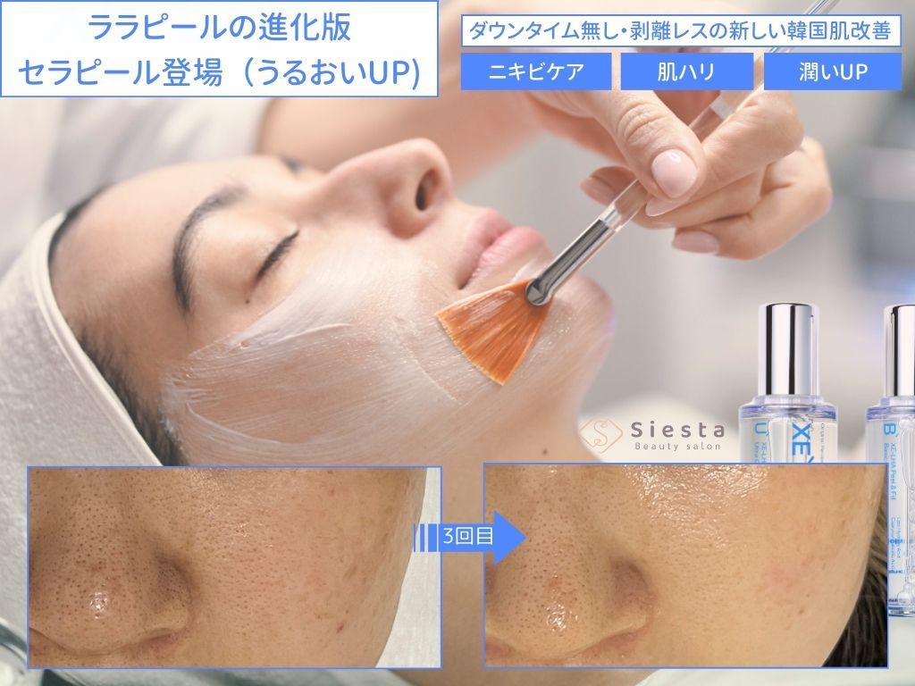 シエスタ(siesta)｜ホットペッパービューティー