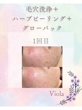 ビオラ(viola)/ニキビ・強い赤みが気になる方！