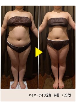 ルアン 八千代台店(Ruang)/お客様ビフォーアフター