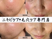 サロン ド エン(Salon de. en)