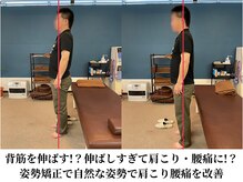 みつばち鍼灸整骨院/姿勢矯正で自然に立てるように