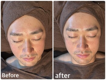 ボヌールデソワ(Bonheur de Soi)/ハーブピーリング/肌ケア/北堀江