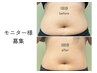 【限定5名様　モニター募集】ぽっこりお腹解消コース　3回￥15000→￥12000