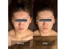 グレースフィオーレ 南越谷店(gracefiore)