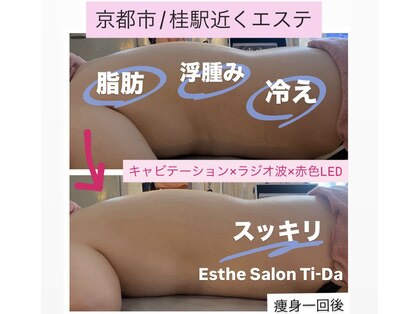 ティーダ(Ti-Da)の写真