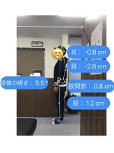 ナオル整体 センター南院(NAORU整体)/AIでの姿勢検査