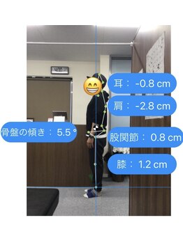 ナオル整体 センター南院(NAORU整体)/AIでの姿勢検査