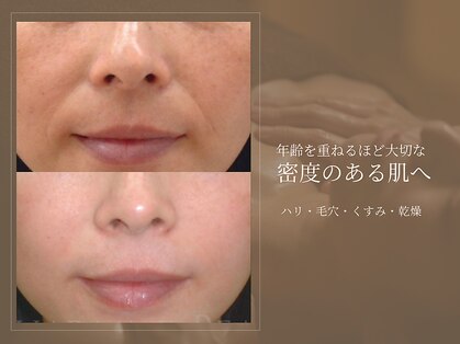 サロン ド ボーテ シャルル(Chaleureux)の写真