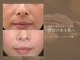 サロン ド ボーテ シャルル(Chaleureux)の写真