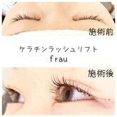 アイラッシュサロン フラウ 新百合ヶ丘店(Eyelash salon frau)