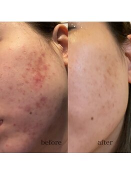 シャルム ド ケー(charme de k)/vosサロンケア