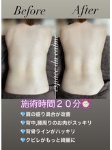 カルマーアンドビー(Calmer & Be.)/【レディース痩身】Before/After