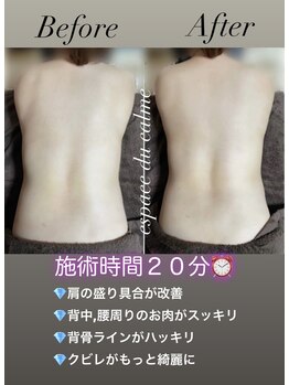 カルマーアンドビー(Calmer & Be.)/【レディース痩身】Before/After
