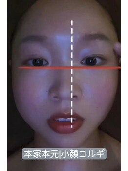 EMI 上野店/#小顔になりたい#毛穴#むくみ