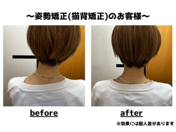 トータルビューティーみつとも/姿勢矯正/猫背矯正