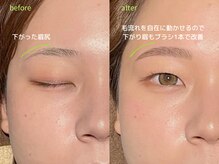 エステマニア(ESUTE MANIA)/ハリウッドブロウリフト施術解説
