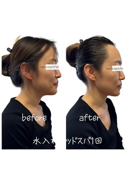 ラヴィソンファム(Ravissant femme)/水入れヘッドスパ1回/40代