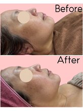 カシェボーテ(CACHE BEAUTE)/