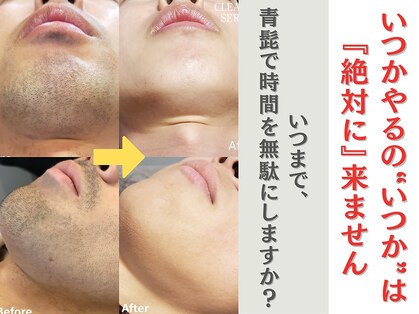 ラッシュ(RUSH)の写真