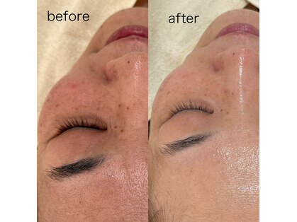 ブルーミー(BlooMe)の写真