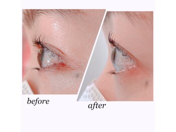アイラッシュサロン ブラン イオンモール天童店(Blanc)/before/after★まつ毛パーマ