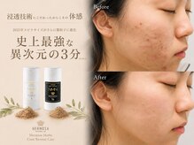 アネラ(ANELA)の雰囲気（ダウンタイムの少ないハーブピーリング）