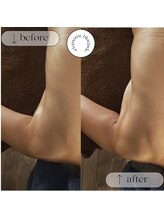 ブルー ジェイド(BLUE JADE)/筋膜リリースbefore　after