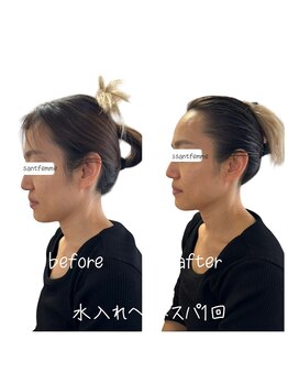 ラヴィソンファム(Ravissant femme)/水入れヘッドスパ1回／40代