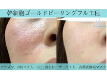 リメイク 広尾(REMAKE)/