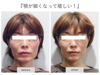 エピファニー(Epiphany)/50代　諦めていたエラやIT首が…