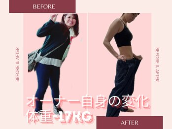 ヨサパーク モア(YOSA PARK Moa)/Before・After