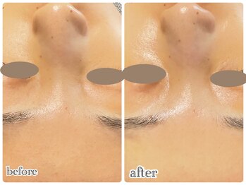 ニュイ(nuit)/明るいツヤ感のあるお肌に！