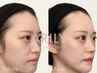 人気！【FACIAL回数】骨・切り特化！60分　6回　(1回当たり¥13,800)