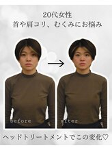 シナジェ 並木通り店(Synergye)/脳ケアで小顔も手に入る！