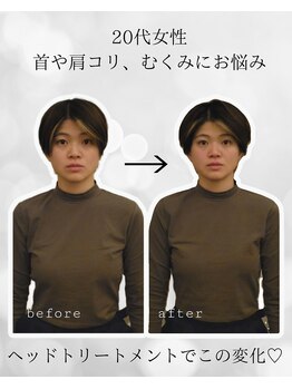 シナジェ 並木通り店(Synergye)/脳ケアで小顔も手に入る！