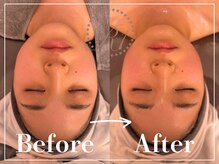 R-1ビューティーサロン 表参道/Before＆After