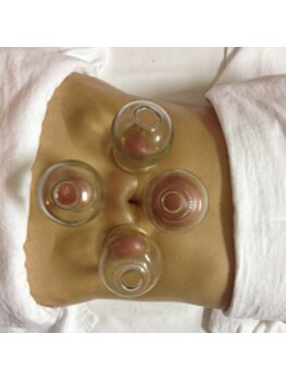 華陽整体サロン 桜木町本店/吸玉で血行促進&ダイエット効果!